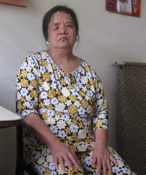 Kinh h&atilde;i l&agrave;n da x&ugrave; x&igrave; như da c&oacute;c   1