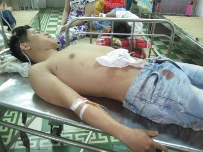 Bị đ&acirc;m trọng thương đ&uacute;ng m&ugrave;ng 1 Tết 1