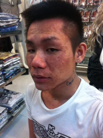T&acirc;m sự của &ldquo;hot boy&rdquo; h&oacute;a &ldquo;dị nh&acirc;n&rdquo; v&igrave; tẩy trắng da 2
