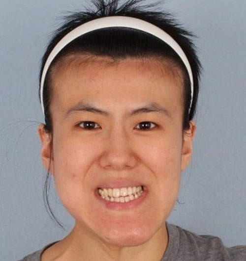 Cuộc "lột x&aacute;c" ngoạn mục của c&aacute;c c&ocirc; g&aacute;i xấu x&iacute; 17