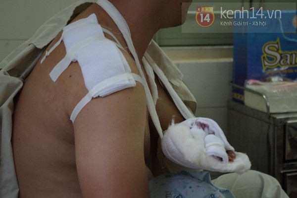 Cận cảnh hung thủ 17 tuổi g&acirc;y ra vụ cướp tiệm v&agrave;ng kinh ho&agrave;ng 15