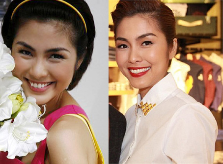 Nghi &aacute;n H&agrave; Tăng từng chỉnh sửa mũi 16