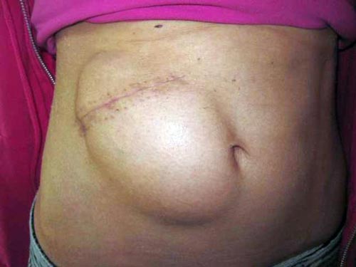 Những ca phẫu thuật cấy gh&eacute;p kh&ocirc;ng thể n&agrave;o tin nổi  3