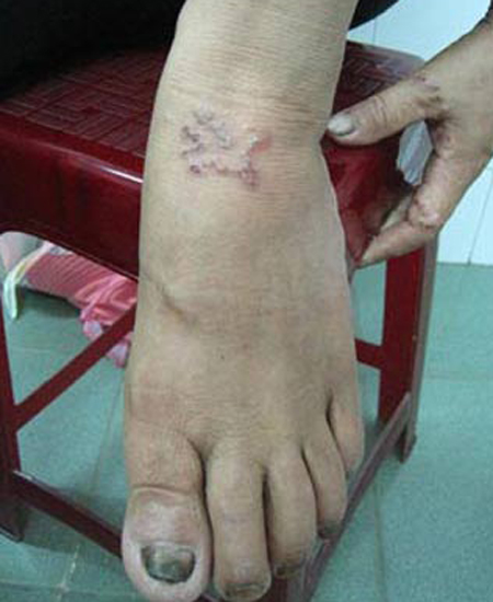 Kinh h&atilde;i giun, gi&ograve;i sống trong cơ thể người 4