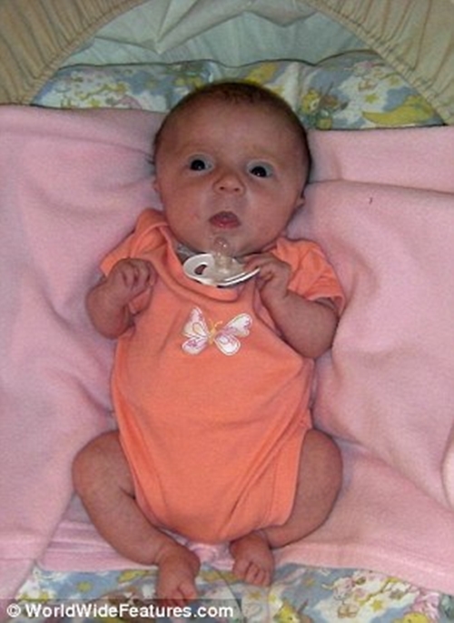 B&eacute; g&aacute;i "b&uacute;p b&ecirc;" ch&agrave;o đời với 30 chiếc xương g&atilde;y 2