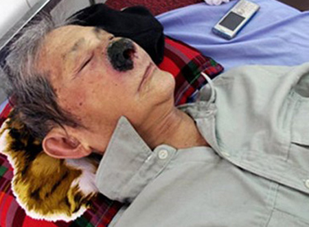 Kinh h&atilde;i giun, gi&ograve;i sống trong cơ thể người 6