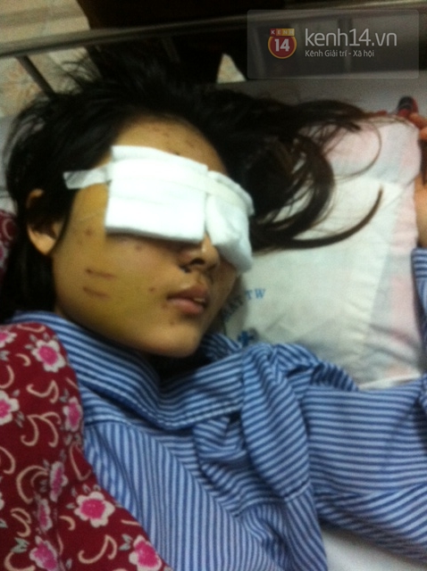 X&oacute;t xa khi gặp c&ocirc; g&aacute;i 19 tuổi bị người y&ecirc;u bắn n&aacute;t mặt 2