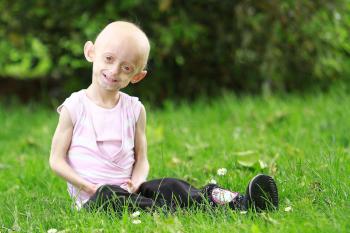 X&oacute;t xa những em b&eacute; trong h&igrave;nh h&agrave;i cụ gi&agrave; 1