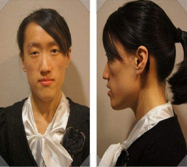 Cuộc "lột x&aacute;c" ngoạn mục của c&aacute;c c&ocirc; g&aacute;i xấu x&iacute; 11