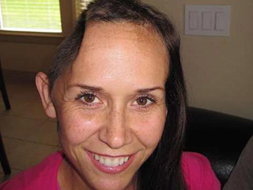 Những ca phẫu thuật cấy gh&eacute;p kh&ocirc;ng thể n&agrave;o tin nổi  2