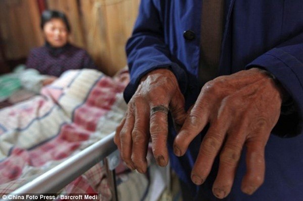 Cảm động gia đ&igrave;nh tự chế m&aacute;y thở cứu con 7