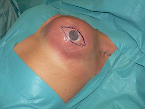 Những chuyện o&aacute;i ăm với... v&ograve;ng 1 7