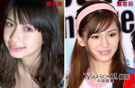 Những sao nữ Cbiz bị nghi thẩm mỹ ở c&ugrave;ng một nơi 9