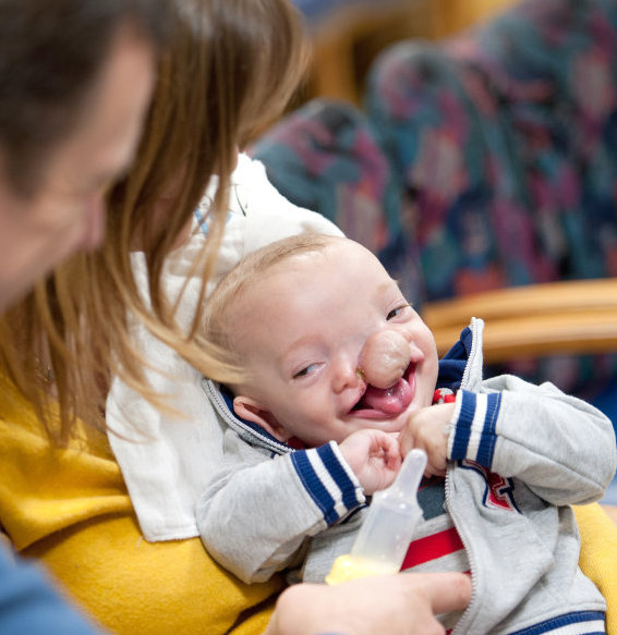 Thương t&acirc;m b&eacute; sơ sinh c&oacute; khu&ocirc;n mặt bị... t&aacute;ch đ&ocirc;i   1