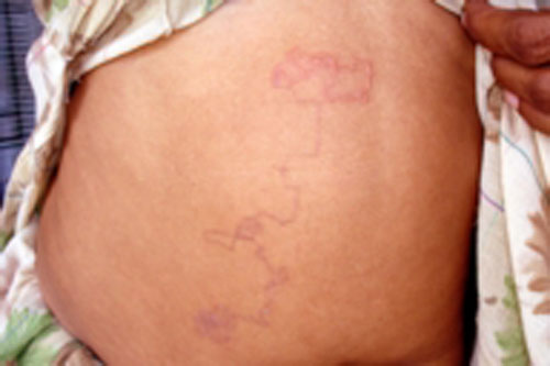 Kinh h&atilde;i giun, gi&ograve;i sống trong cơ thể người 5