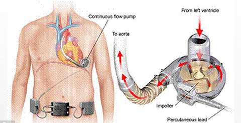 Những ca phẫu thuật cấy gh&eacute;p kh&ocirc;ng thể n&agrave;o tin nổi  8