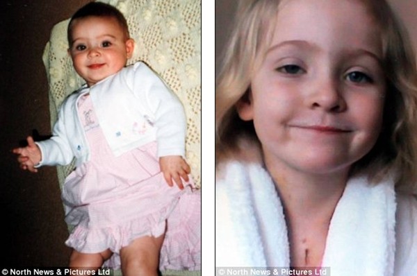 B&eacute; g&aacute;i sinh ra với một nửa tr&aacute;i tim 1