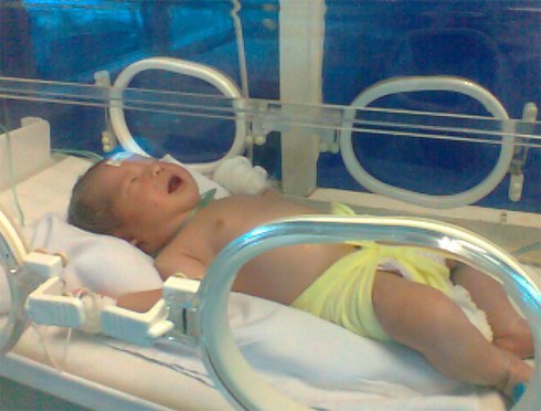 Quảng B&igrave;nh: B&eacute; sơ sinh c&oacute; lưỡi như ch&ugrave;m nho 2