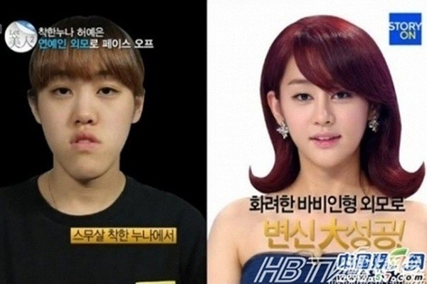 Cuộc "lột x&aacute;c" ngoạn mục của c&aacute;c c&ocirc; g&aacute;i xấu x&iacute; 2