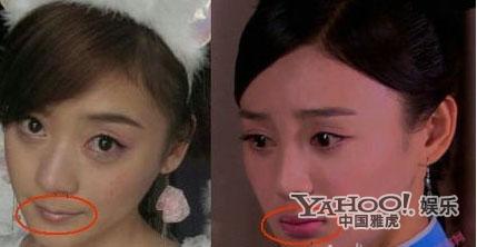 Những sao nữ Cbiz bị nghi thẩm mỹ ở c&ugrave;ng một nơi 5