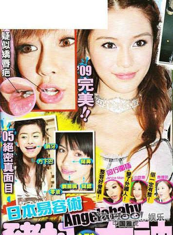 Những sao nữ Cbiz bị nghi thẩm mỹ ở c&ugrave;ng một nơi 8