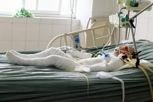 Ch&aacute;u b&eacute; thứ 2 vụ cả nh&agrave; bị tưới xăng thi&ecirc;u sống đ&atilde; chết 1