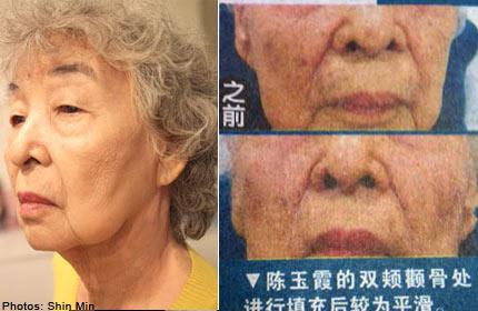 Kết quả giật m&igrave;nh khi c&aacute;c cụ b&agrave; chi tiền "khủng" đại tu nhan sắc 1