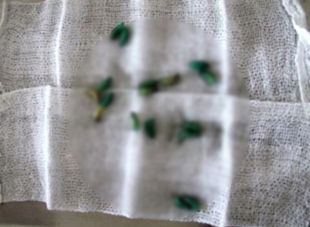 Kinh h&atilde;i giun, gi&ograve;i sống trong cơ thể người 7