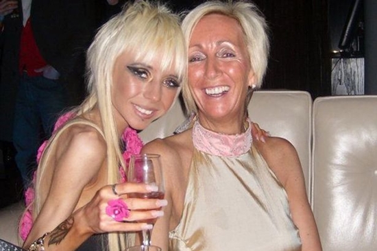 Những c&ocirc; g&aacute;i gầy giơ xương chiến đấu với bệnh biếng ăn 14