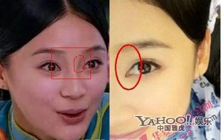 Những sao nữ Cbiz bị nghi thẩm mỹ ở c&ugrave;ng một nơi 4