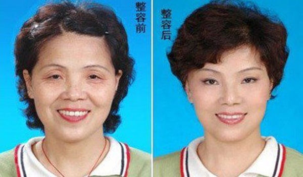 Kết quả giật m&igrave;nh khi c&aacute;c cụ b&agrave; chi tiền "khủng" đại tu nhan sắc 8