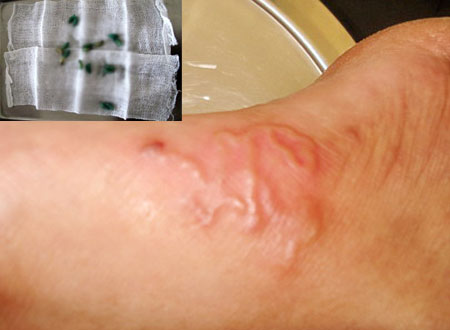 Kinh h&atilde;i giun, gi&ograve;i sống trong cơ thể người 1