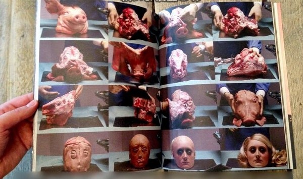 Những ca phẫu thuật thẩm mỹ o&aacute;i oăm nhất thế giới 1