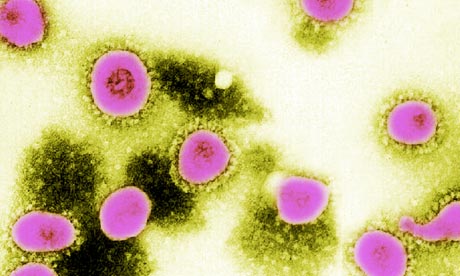 Xuất hiện virus chết người chủng mới 1
