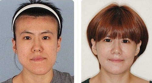 Cuộc "lột x&aacute;c" ngoạn mục của c&aacute;c c&ocirc; g&aacute;i xấu x&iacute; 24