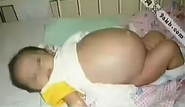 Những chuyện kh&oacute; tin khi sinh nở 5