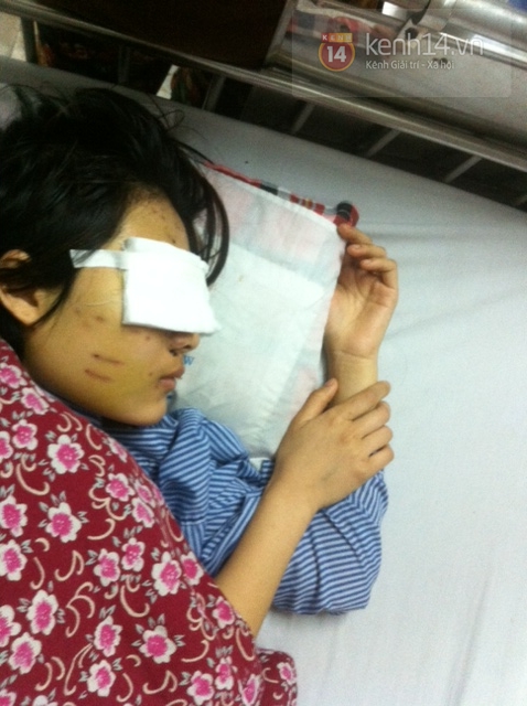 X&oacute;t xa khi gặp c&ocirc; g&aacute;i 19 tuổi bị người y&ecirc;u bắn n&aacute;t mặt 3