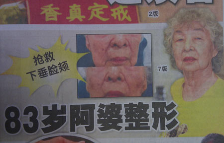 Kết quả giật m&igrave;nh khi c&aacute;c cụ b&agrave; chi tiền "khủng" đại tu nhan sắc 4