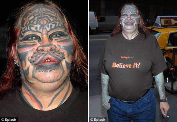 Những ca phẫu thuật thẩm mỹ o&aacute;i oăm nhất thế giới 3