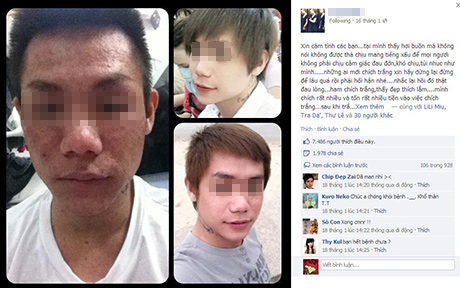 Cư d&acirc;n mạng x&ocirc;n xao "hot boy" h&oacute;a "dị nh&acirc;n" bởi tẩy trắng da 1