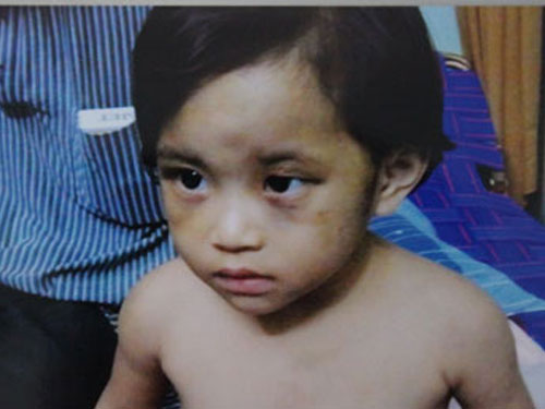 Mẹ đi l&agrave;m, b&eacute; 2 tuổi bị cha dượng bạo h&agrave;nh 1