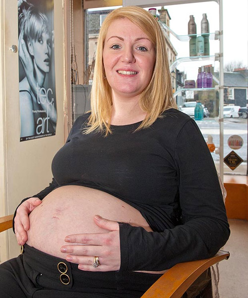 Ngạc nhi&ecirc;n bụng bầu c&oacute; h&igrave;nh mặt em b&eacute; 2