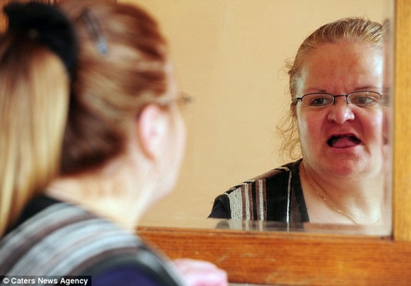 B&eacute; g&aacute;i c&oacute; h&agrave;m răng "kinh dị" bọc to&agrave;n kim loại 5