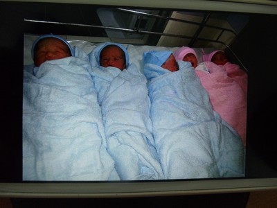 Kỳ diệu ca sinh 5 th&agrave;nh c&ocirc;ng đầu ti&ecirc;n tại Việt Nam  1