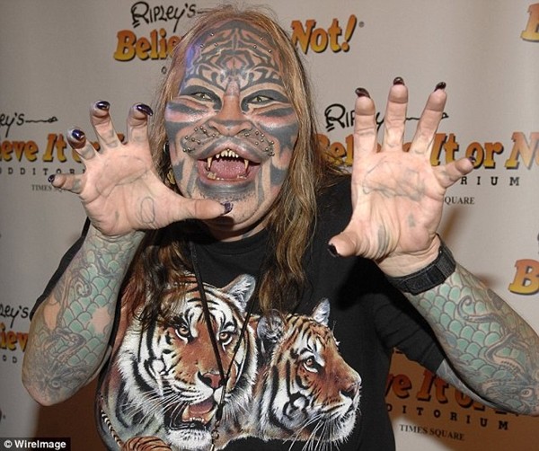 Những ca phẫu thuật thẩm mỹ o&aacute;i oăm nhất thế giới 4