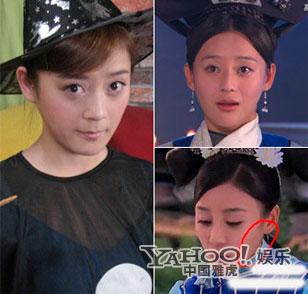 Những sao nữ Cbiz bị nghi thẩm mỹ ở c&ugrave;ng một nơi 3