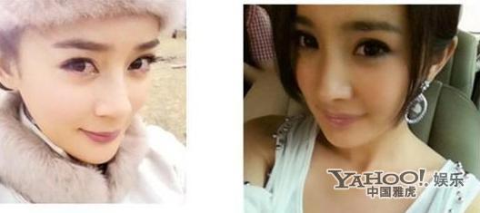 Những sao nữ Cbiz bị nghi thẩm mỹ ở c&ugrave;ng một nơi 12