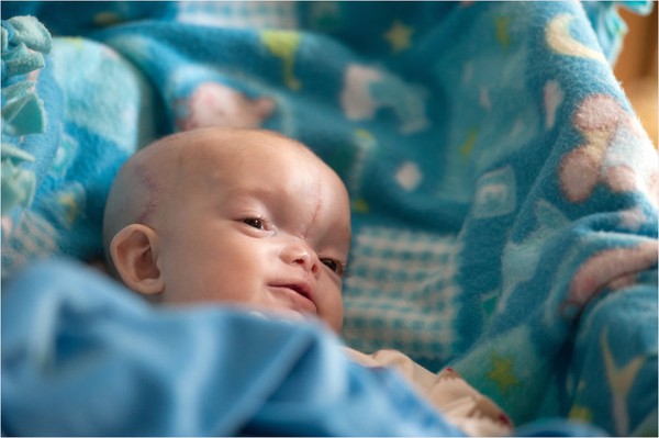 Thương t&acirc;m b&eacute; sơ sinh c&oacute; khu&ocirc;n mặt bị... t&aacute;ch đ&ocirc;i   3