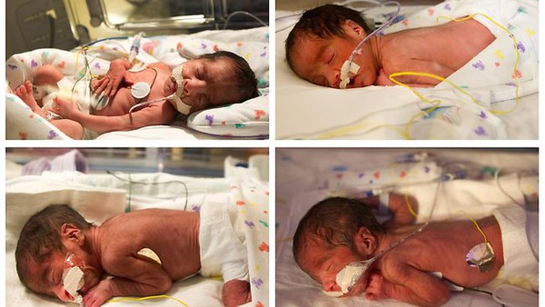 B&agrave; mẹ sinh con kiểu... 70 triệu ca mới c&oacute; một 3