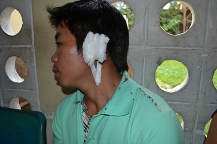 Cả nh&agrave; ch&uacute; rể nhập viện trong ng&agrave;y cưới v&igrave; thực kh&aacute;ch m&acirc;u thuẫn 1